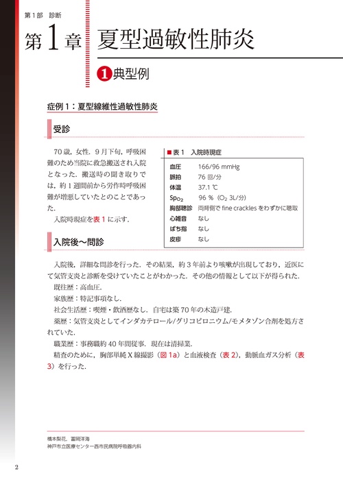症例から学ぶ『過敏性肺炎診療指針』の使い方