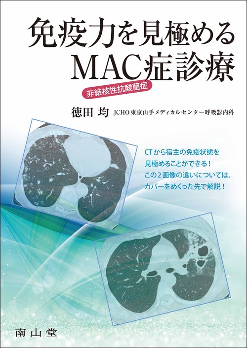 免疫力を見極める 非結核性抗酸菌症（MAC症）診療