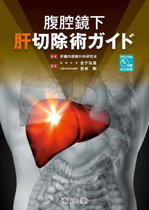 腹腔鏡下肝切除術ガイド