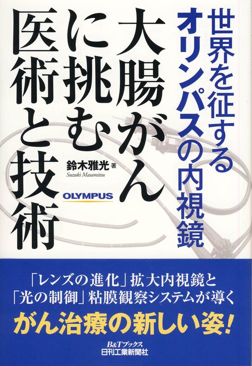 大腸がんに挑む医術と技術 世界を征するオリンパスの内視鏡