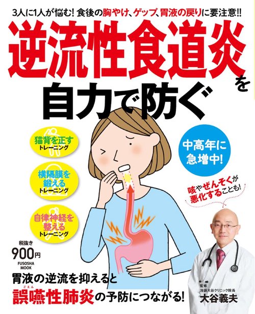 逆流性食道炎を自力で防ぐ 3人に1人が悩む!食後の胸やけ、ゲップ、胃液の戻りに要注意!!