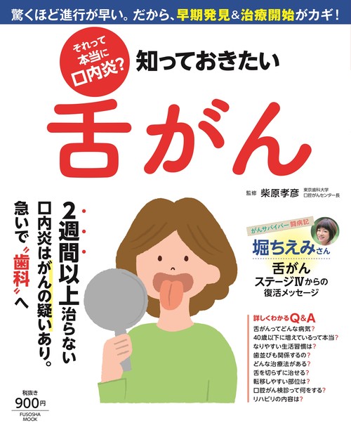 それって本当に口内炎?知っておきたい舌がん 驚くほど進行が早い。だから、早期発見&治療開始がカギ!
