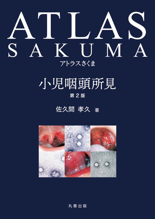 アトラスさくま 小児咽頭所見　第2版