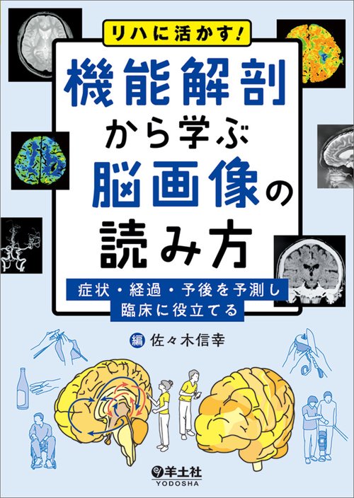 リハに活かす！機能解剖から学ぶ脳画像の読み方