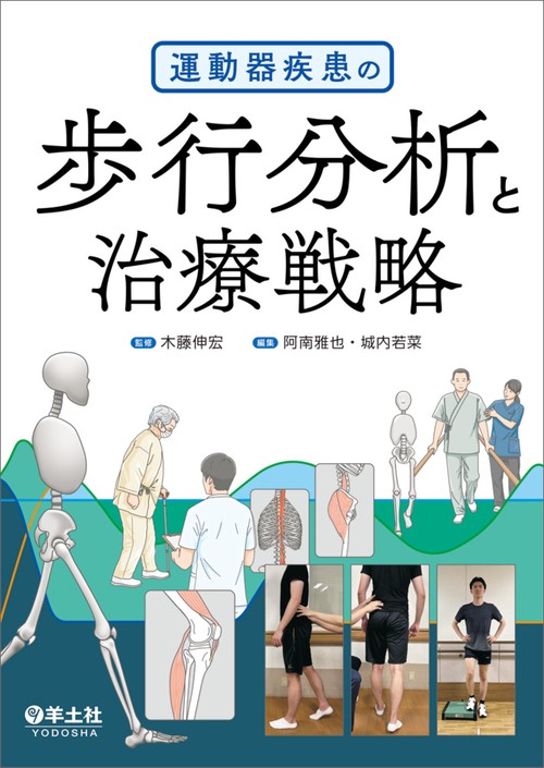 運動器疾患の歩行分析と治療戦略