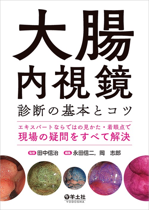 大腸内視鏡診断の基本とコツ