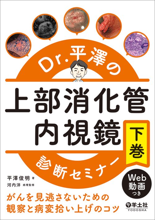 Dr.平澤の上部消化管内視鏡診断セミナー　下巻