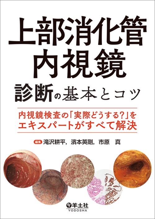 上部消化管内視鏡診断の基本とコツ
