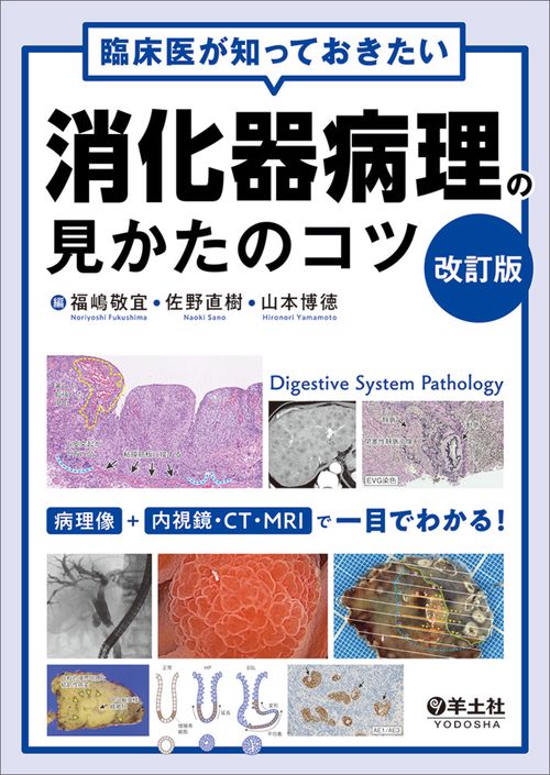 臨床医が知っておきたい消化器病理の見かたのコツ　改訂版