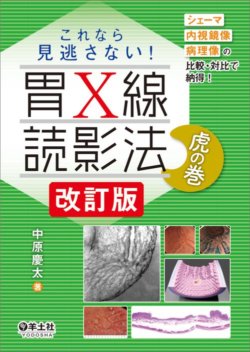これなら見逃さない！胃X線読影法　虎の巻　改訂版