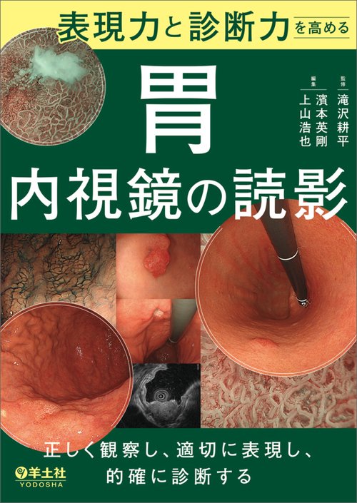 表現力と診断力を高める　胃内視鏡の読影