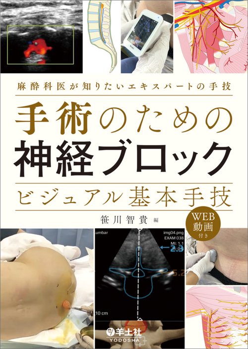 手術のための神経ブロック　ビジュアル基本手技
