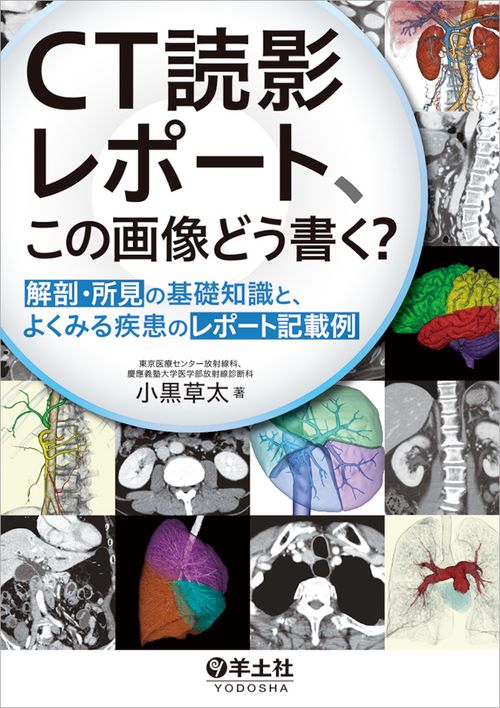 CT読影レポート、この画像どう書く？