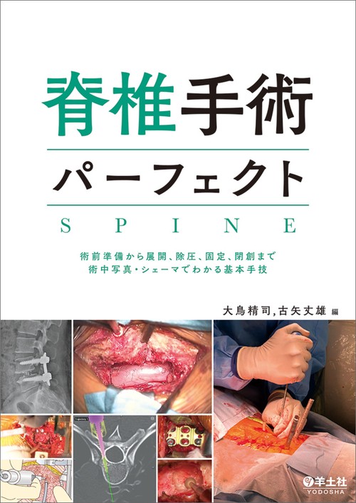 脊椎手術パーフェクト