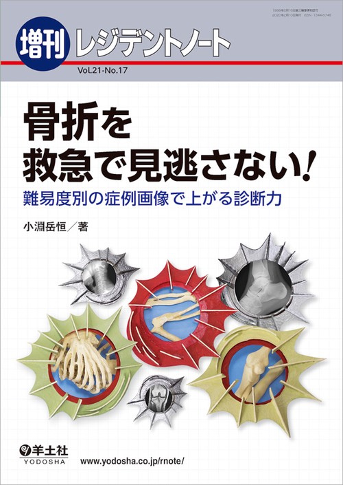 骨折を救急で見逃さない！