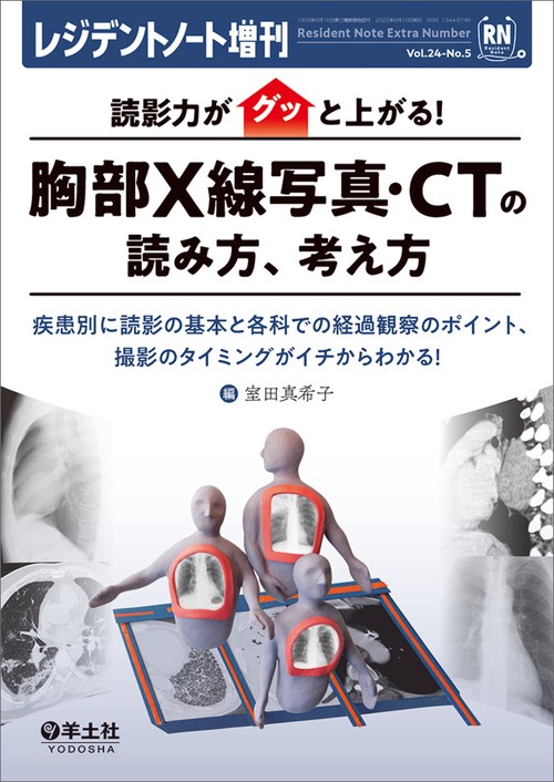 読影力がグッと上がる！胸部X線写真・CTの読み方、考え方