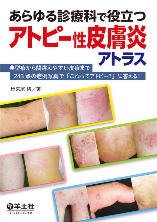 あらゆる診療科で役立つアトピー性皮膚炎アトラス