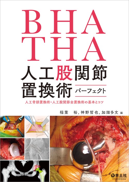 BHA・THA 人工股関節置換術パーフェクト