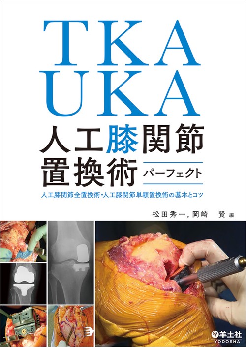 TKA・UKA　人工膝関節置換術パーフェクト