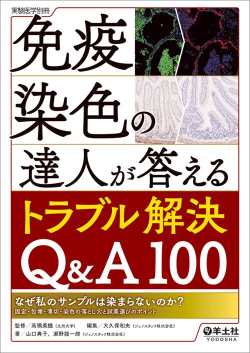 免疫染色の達人が答えるトラブル解決Q&A100
