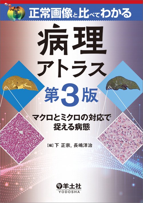正常画像と比べてわかる　病理アトラス　第3版