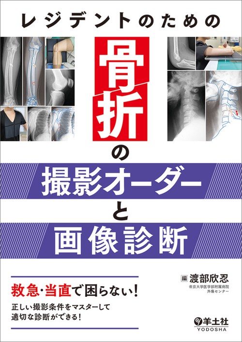 レジデントのための骨折の撮影オーダーと画像診断