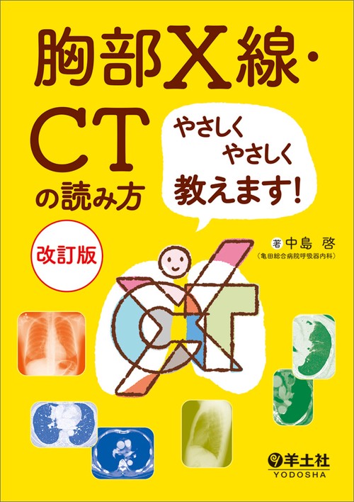 胸部X線・CTの読み方やさしくやさしく教えます！改訂版