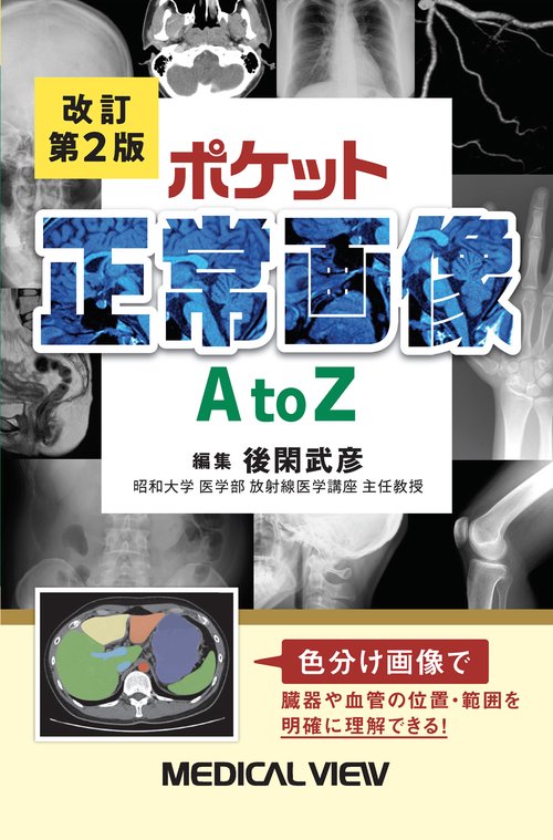 ポケット正常画像　A to Z