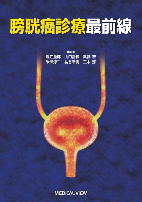 膀胱癌診療最前線