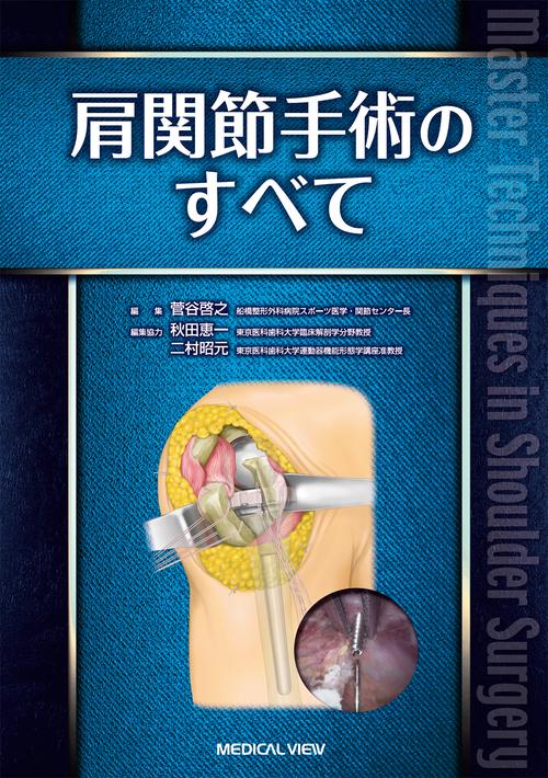 肩関節手術のすべて