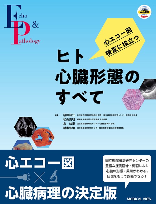 心エコー図検査に役立つ　ヒト心臓形態のすべて