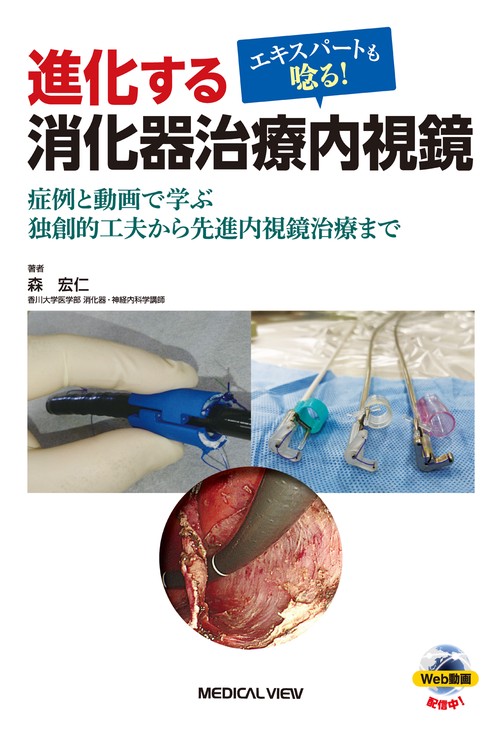 エキスパートも唸る　進化する消化器治療内視鏡