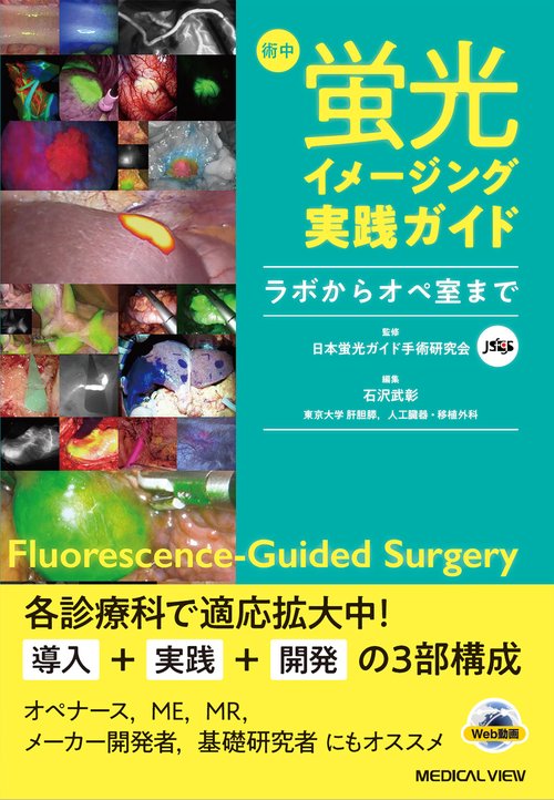術中蛍光イメージング実践ガイド
