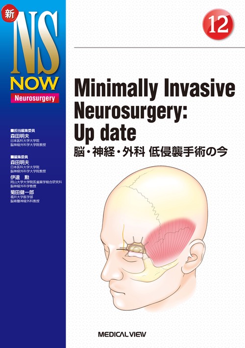 Minimally Invasive Neurosurgery：Up date