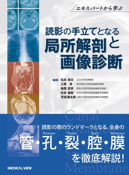 Canal, Foramen, Fissure, Space ＆ Membrane　読影の手立てとなる局所解剖と画像診断