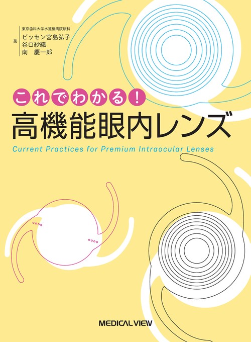 これでわかる！　高機能眼内レンズ