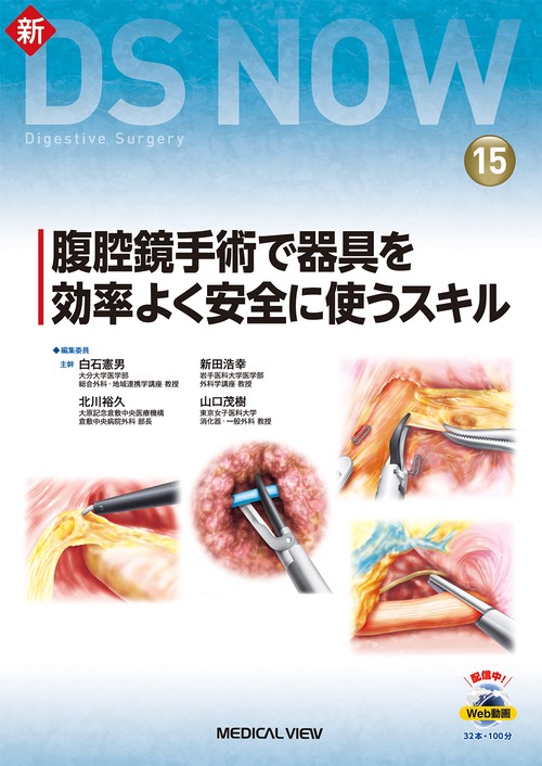 腹腔鏡手術で器具を効率よく安全に使うスキル