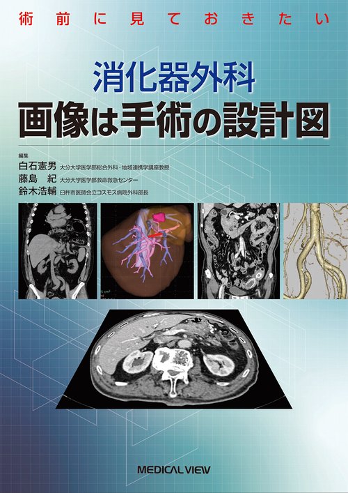 術前に見ておきたい 消化器外科　画像は手術の設計図