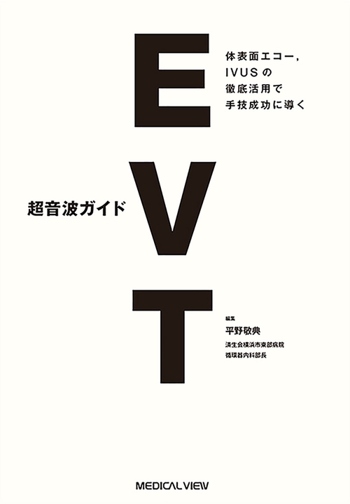 超音波ガイドEVT　体表面エコー，IVUSの徹底活用で手技成功に導く