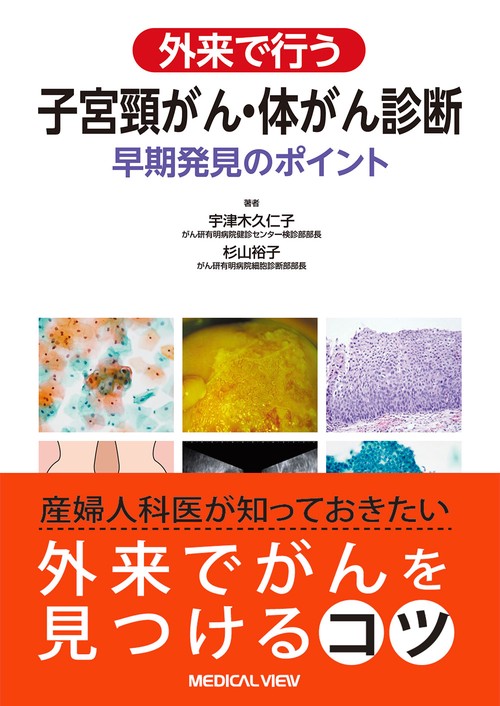 外来で行う子宮頸がん・体がん診断