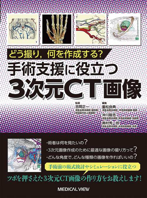 どう撮り，何を作成する？　手術支援に役立つ3次元CT画像