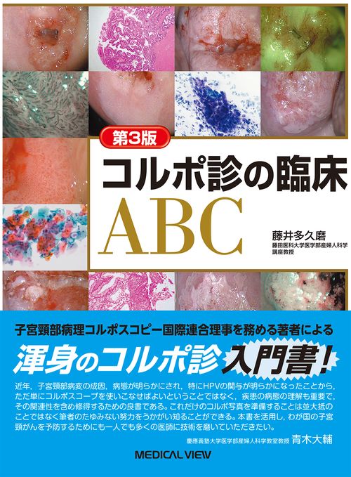 コルポ診の臨床ABC