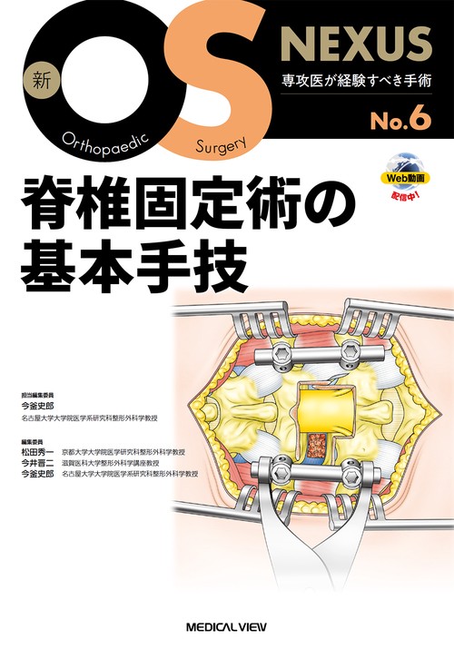 脊椎固定術の基本手技