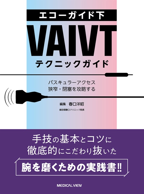 エコーガイド下VAIVTテクニックガイド
