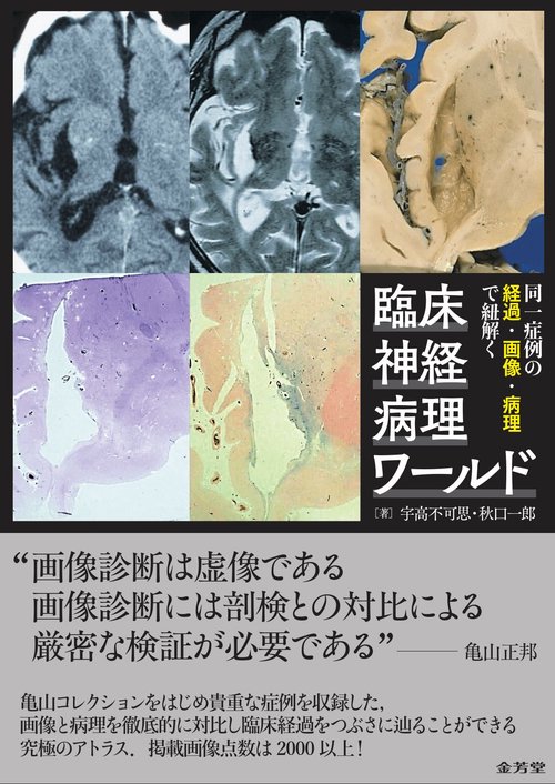 同一症例の経過・画像・病理で紐解く　臨床神経病理ワールド