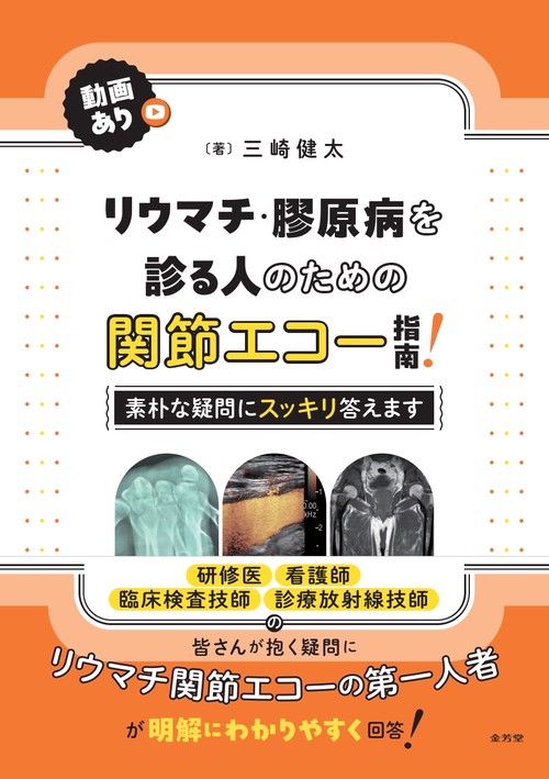 リウマチ・膠原病を診る人のための関節エコー指南！
