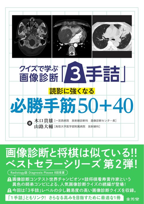 クイズで学ぶ画像診断「3手詰」　読影に強くなる必勝手筋50+40