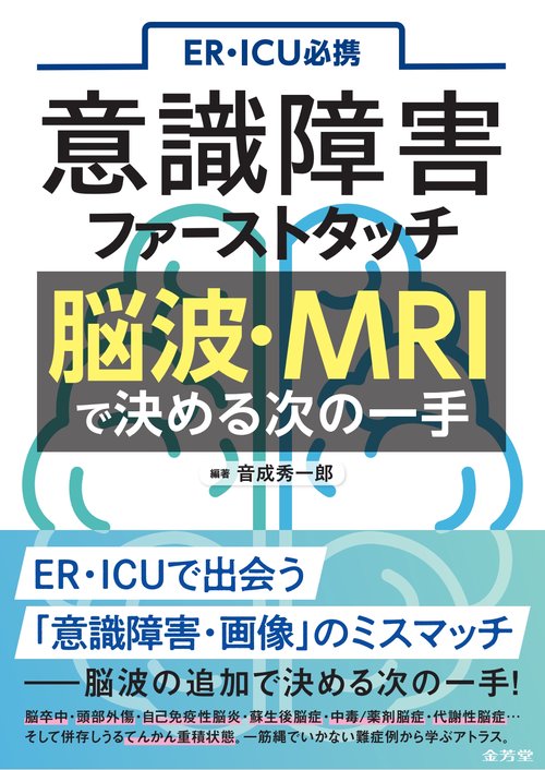ER・ICU必携　意識障害ファーストタッチ　脳波・MRIで決める次の一手