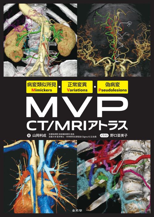 病変類似所見Mimickers・正常変異Variations・偽病変Pseudolesions　MVP CT/MRIアトラス