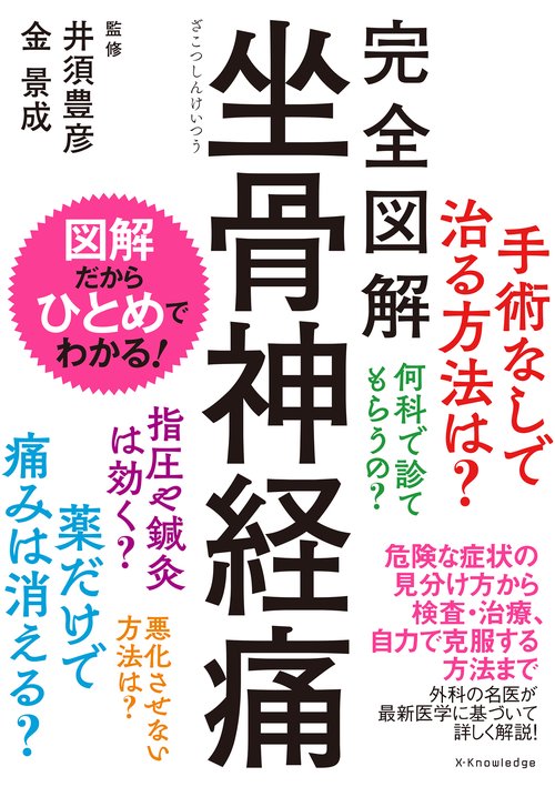 完全図解 坐骨神経痛